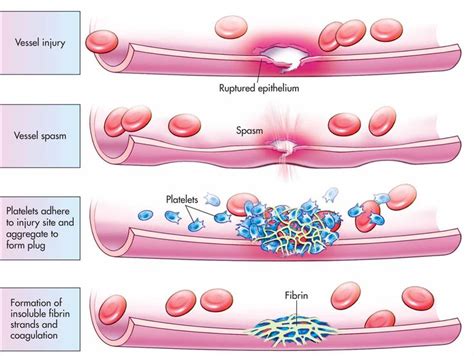 Basic steps in hemostasis. - Biology Forums Gallery | Medical school studying, College nursing ...