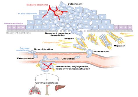 SHOWS THE PRINCIPAL STEPS IN METASTASIS [3] | Download Scientific Diagram