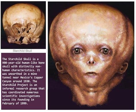 STARCHILD.........SOURCE BING IMAGES...........Starchild Skull: found in Mexico ~1930 claimed to ...