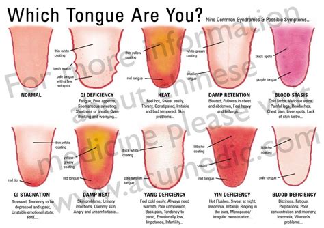 Basic Tongue Diagnosis Chart - AcuMedic Clinic