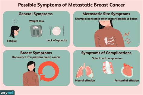 Symptoms of metastatic bone cancer | doctorvisit