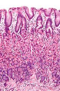 The Stomach | Boundless Anatomy and Physiology