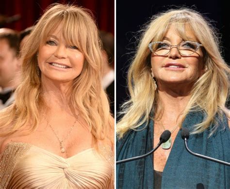 Goldie Hawn before and after plastic surgery 02 – Celebrity plastic surgery online