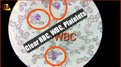 Blood Slide for RBC, WBC, Platelet to See what kind of under the ...