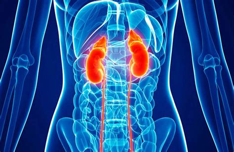 Kidney infection : Symptoms and causes