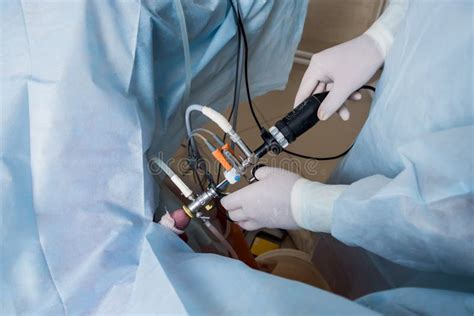 Process of Urological Surgery Operation Using Laparoscopic Equipment ...