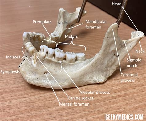 Mandibular Fractures | Anatomy, Management | Geeky Medics