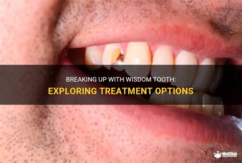 Breaking Up With Wisdom Tooth: Exploring Treatment Options | MedShun