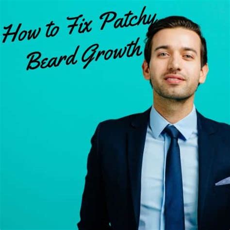 Patchy Beard - How to Fix Patchy Beard Growth