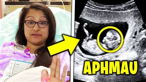 Aphmau is HAVING A BABY.. (PREGNANT) - YouTube