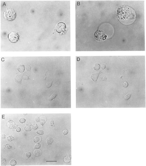 Cell morphology as observed under the microscope during... | Download Scientific Diagram