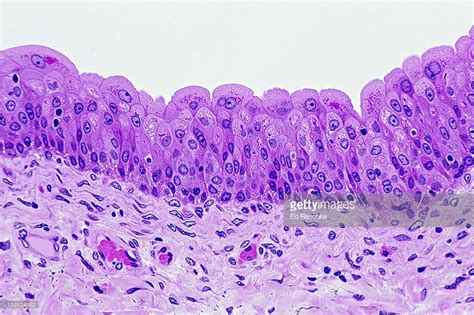 Image result for Transitional epithelium H&e Stain, Histology Slides, Cell Forms, Human Tissue ...