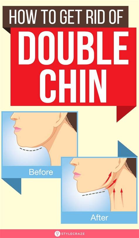 How To Get Rid Of A Double Chin: Exercises And Tips in 2020 | Double chin, How to get rid ...