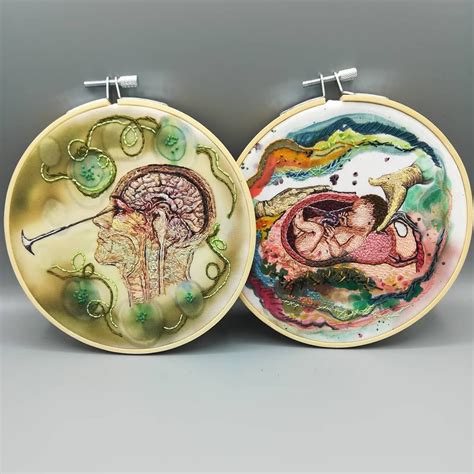 Two very different types of surgery. Ice pick lobotomy and C-section. Both available in my Etsy ...