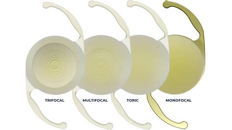 Carolinas Centers For Sight, P.C. - PanOptix Trifocal Lens