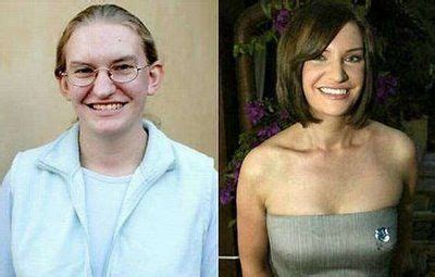Transgender Women Before and After | The wonders of plastic surgery | Curious, Funny Photos ...