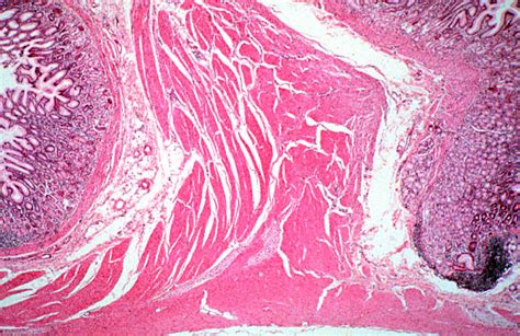 HLS [ Digestive System: Alimentary Canal, pyloro/duodenal junction, pyloric sphincter] MED MAG