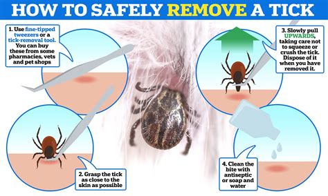 Tick Removal From Humans