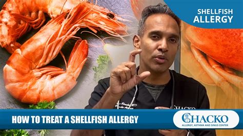 How to Treat a Shellfish Allergy [Chacko Allergy] - YouTube