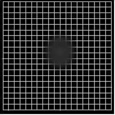 Amsler Recording Chart | Retina Care Atlanta | Georgia Retina