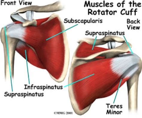 Rotator Cuff Tears | Physical Therapist Tips | FREE phone Consult