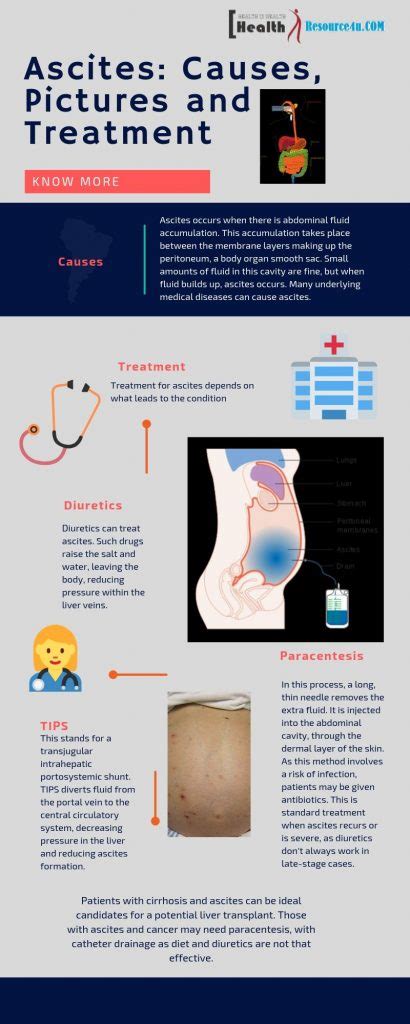 Ascites: Causes, Pictures, Symptoms And Treatment