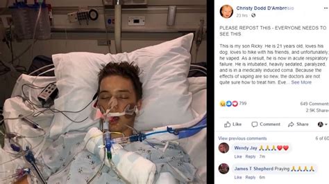 21-year-old hospitalized in what doctor says was 'vaping-induced lung ...