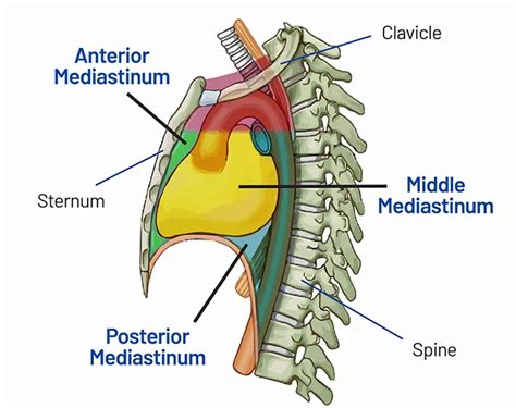 توده های مدیاستن (Mediastinal Mass) | دکتر بهزاد رحمانی