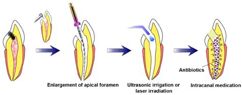 Biomimetics | Free Full-Text | Biomimetic Approaches in Clinical ...