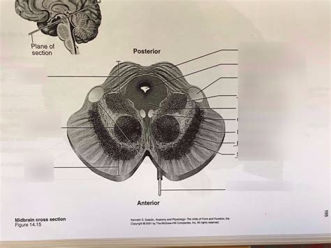 Midbrain cross section Diagram | Quizlet