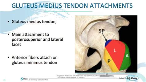 MRI Hip Gluteal Tendon Anatomy - Radedasia