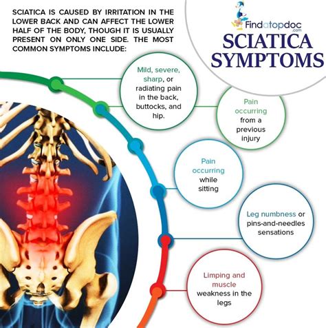 Can Sciatica Pain be Cured?