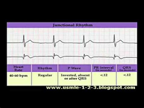 ECG Sinus, Atrial, Junctional Rhythms - YouTube