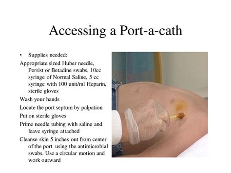 Accessing a Portacath / Port-a-cath | Bugs health | Pinterest