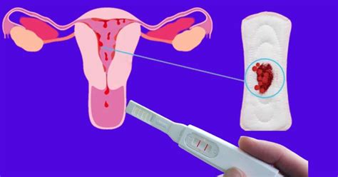 Heavy Implantation Bleeding And Positive Pregnancy Test