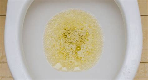 Foamy Urine: Causes, Picture, Symptoms And Treatment