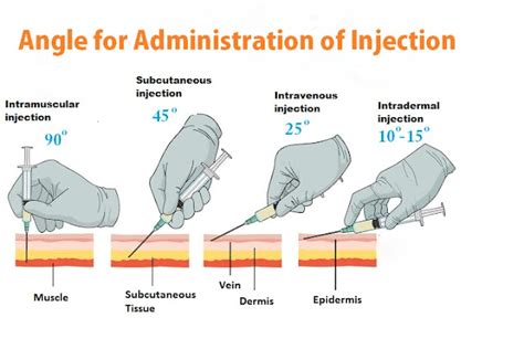 Angles of Administration of Injection - ID, IM, SC, IV