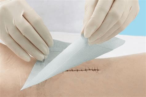 Surgical Wound and Incision Care - The RGV Wound Doc