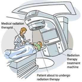 Radiation Therapy Singapore | Radiotherapy Treatment in Singapore | RT cancer treatment | AARO