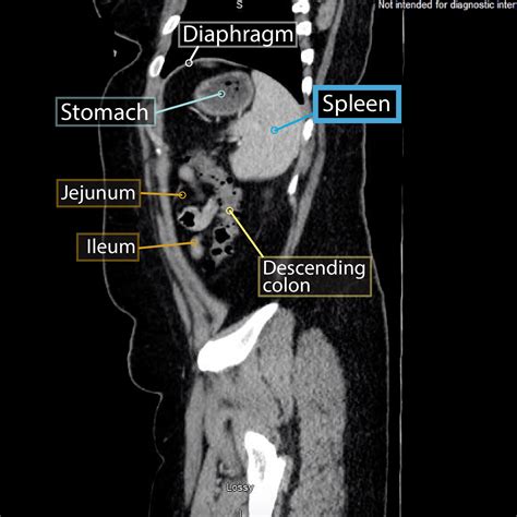 Abdomen Sagittal 11 - vrogue.co