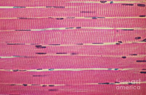 Skeletal Muscle Tissue Diagram Diagram | Quizlet