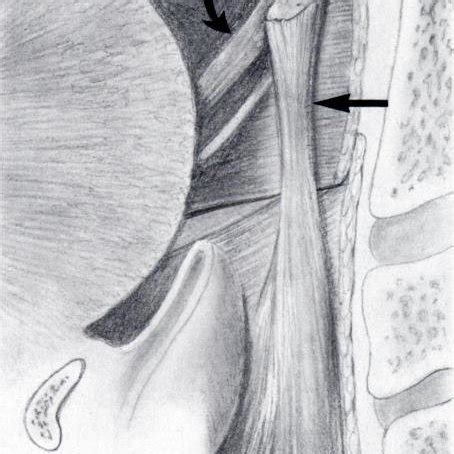 Figure h2 Figure h3 Lymphoid hyperplasia of the palatine tonsil A... | Download Scientific Diagram