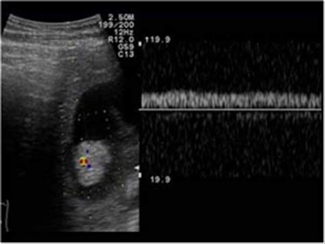 Abdomen and retroperitoneum | 1.2 Gallbladder and bile ducts : Case 1.2 ...