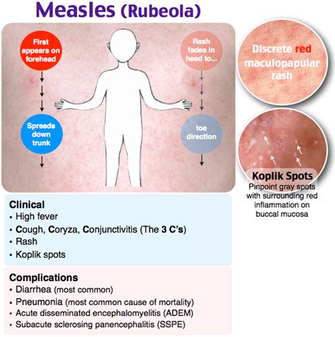 Rubeola Symptoms