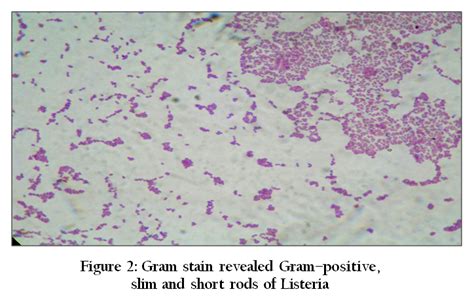 Listeria Gram Stain / Cureus Multiple Listeria Abscesses In An ...