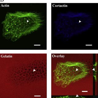 Invasive structures in trophoblast cells are more closely related to... | Download Scientific ...