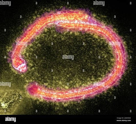 Ebola virus particles, coloured transmission electron micrograph (TEM). This elongated virus ...