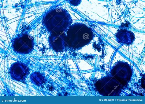 Aspergillus Microscopische View: Bekijk de Intrigerende Wereld van Schimmels Onder een ...