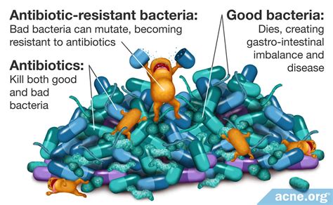 The Dangers and Ineffectiveness of Antibiotics for Acne - Acne.org