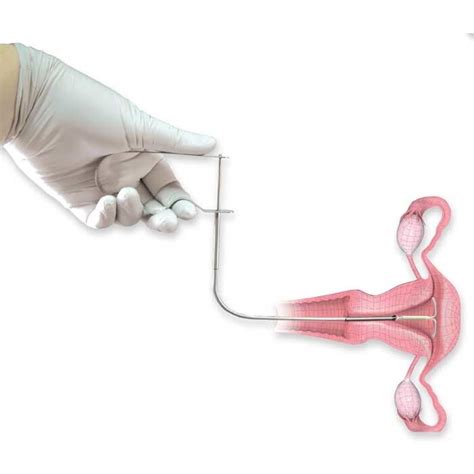 IUD removal tool - flexible Serpentine grasper | Medische Vakhandel